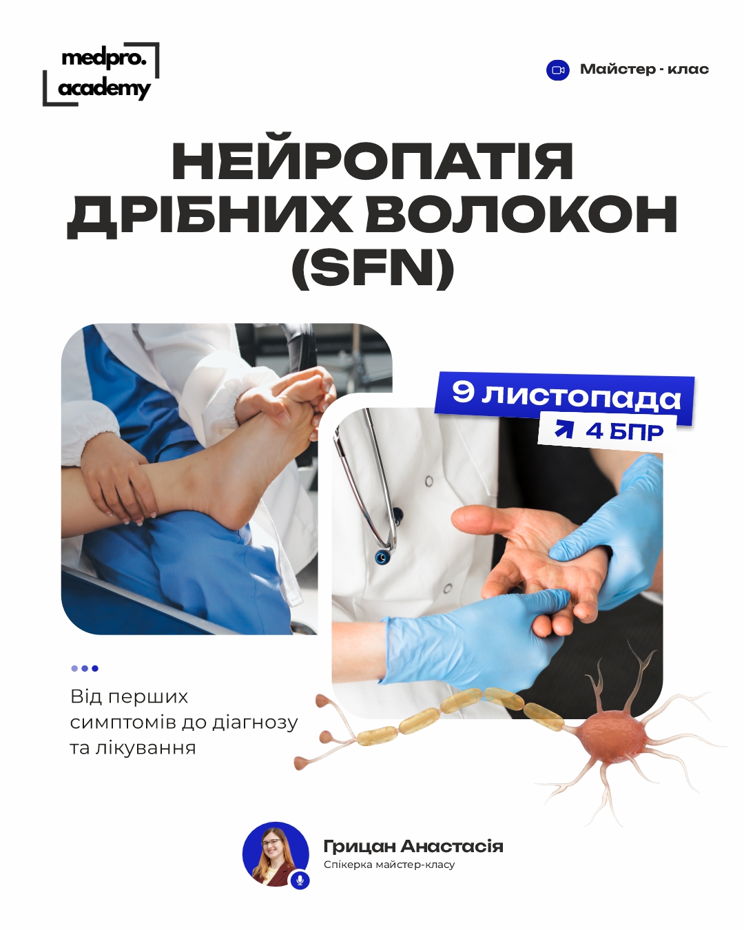 3Нейропатія дрібних волокон (SFN) від перших симптомів до діагнозу та лікування